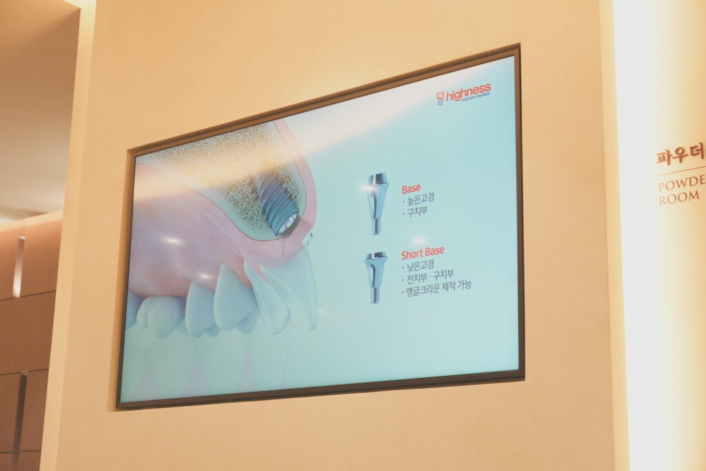비보험임플란트