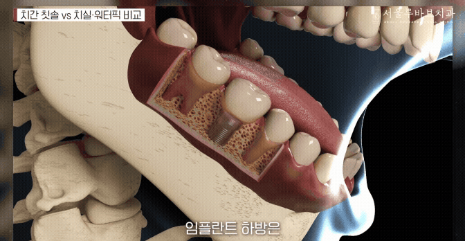 실패
